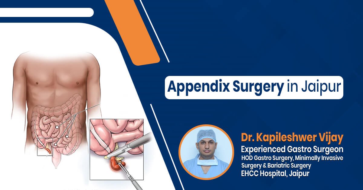 Appendix Surgery in Jaipur By Dr. Kapielshwer Vijay Gastro Clinic