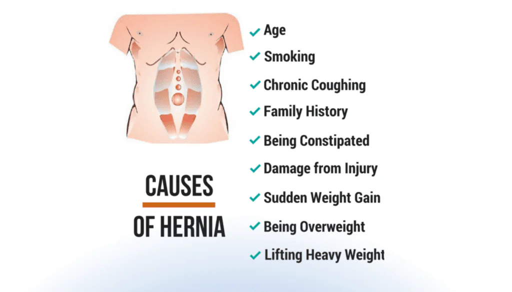What is the main causes of Hernia? 1 Main Causes of Hernia