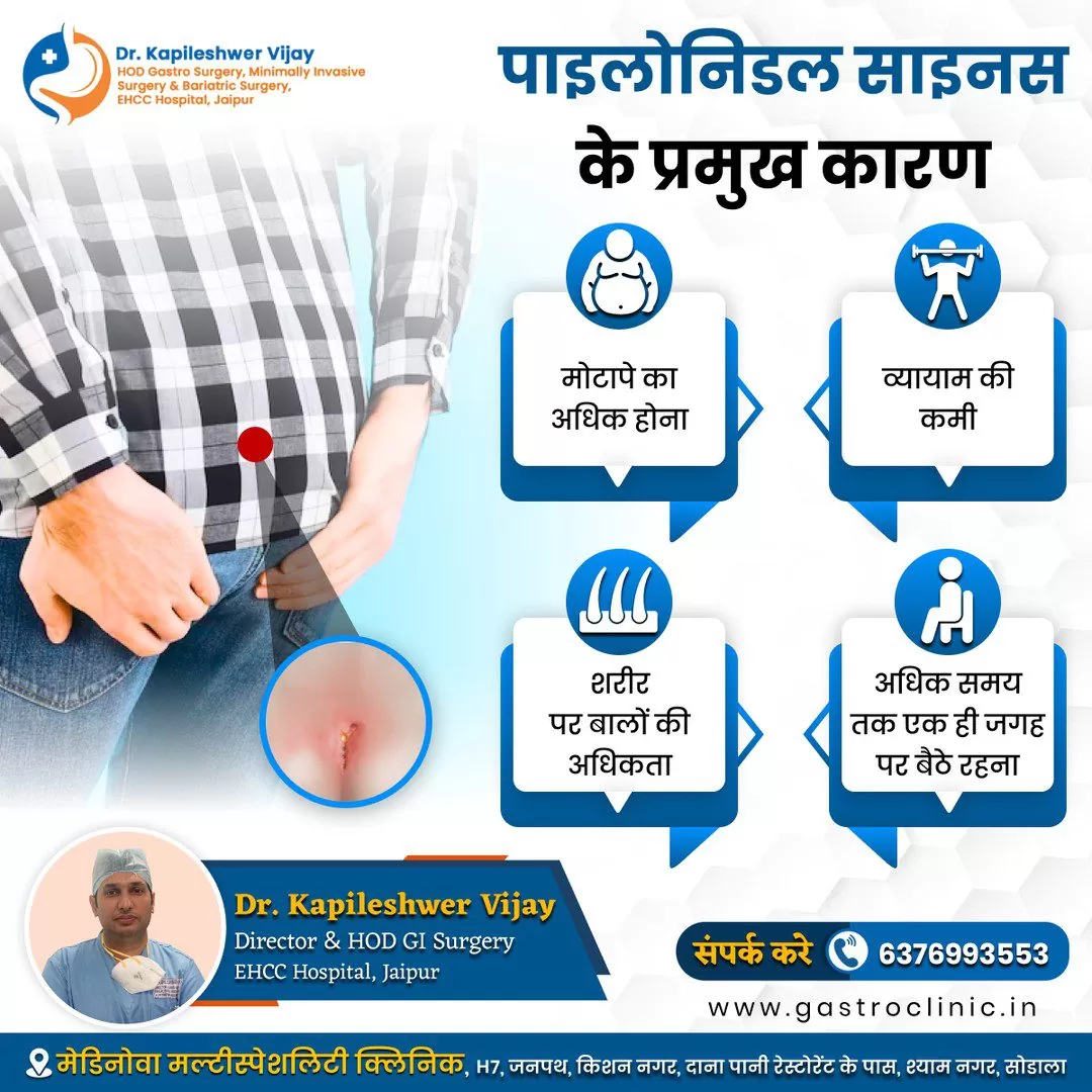 Pilonidal Sinus Causes