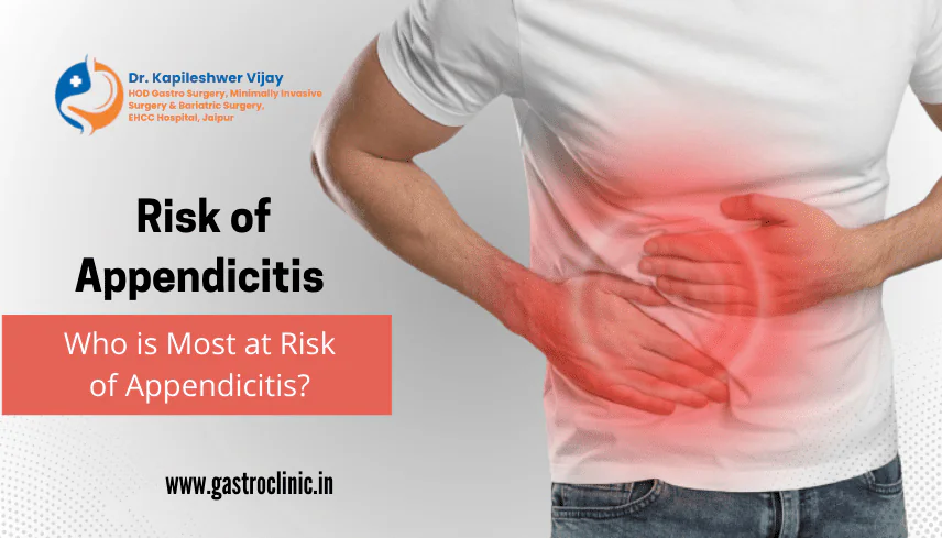 Who is Most at Risk of Appendicitis?