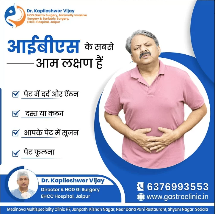 इरिटेबल बॉवेल सिंड्रोम