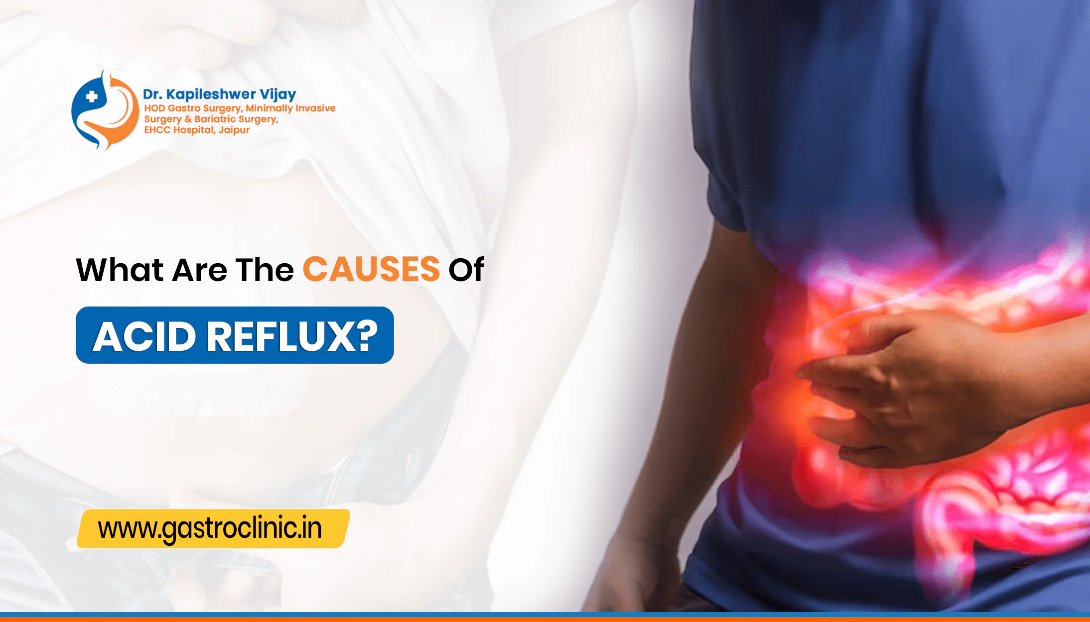 What Are the Causes Of Acid Reflux?