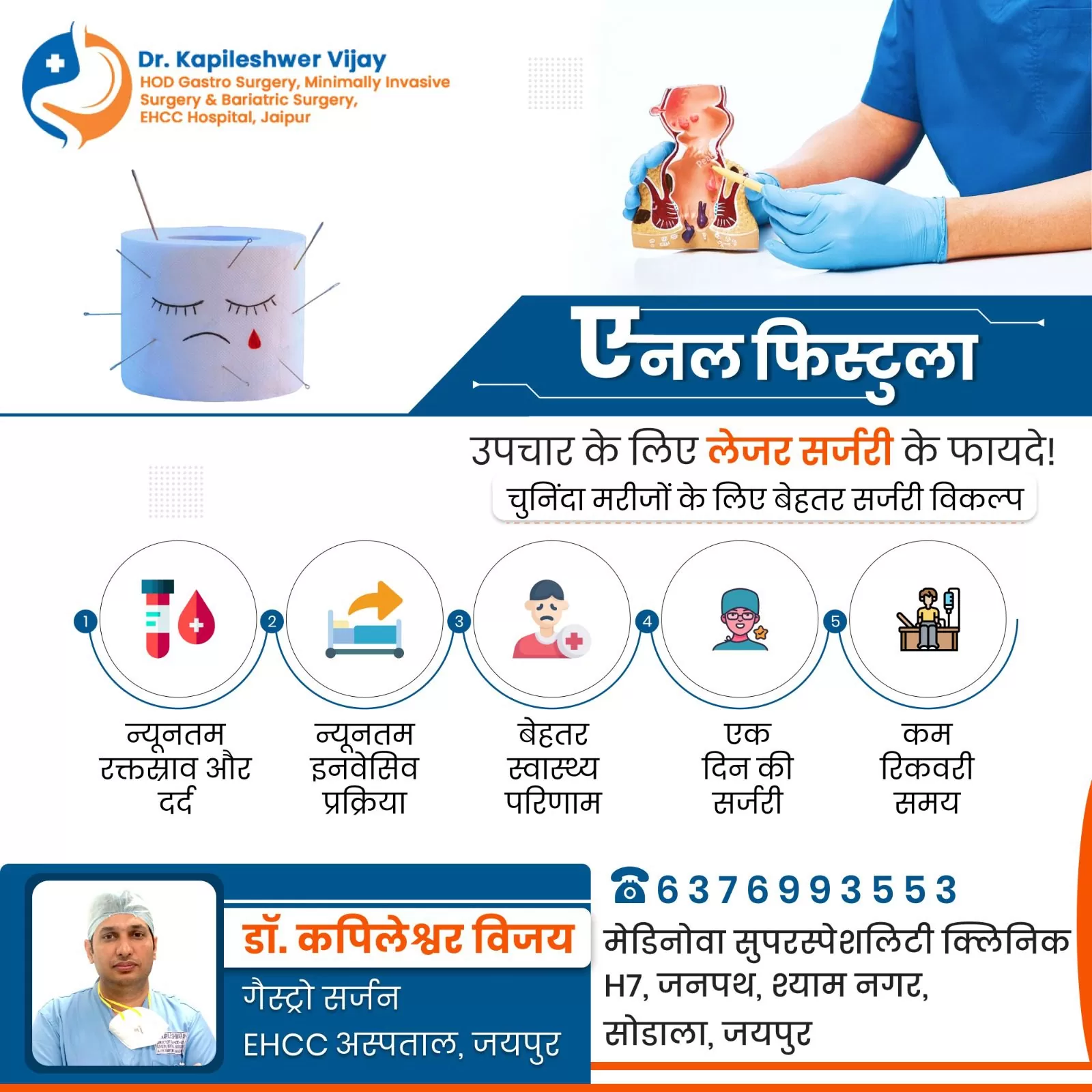 आपके स्वास्थ्य का पहला क़दम – एनल फिस्टुला के इलाज में लेज़र सर्जरी का रूप