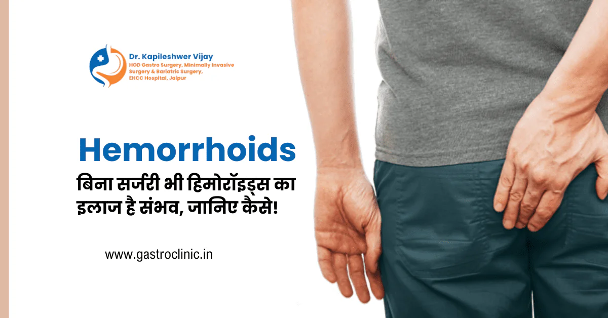 Hemorrhoids : बिना सर्जरी भी हिमोरॉइड्स का इलाज है संभव, जानिए कैसे?