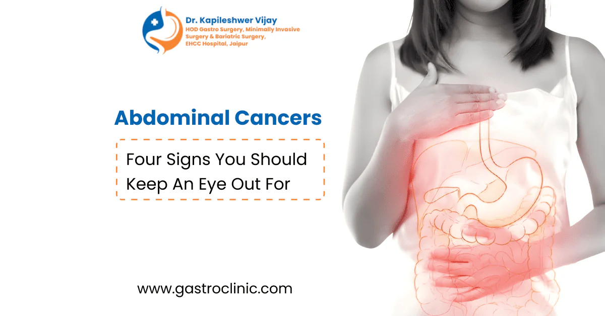 Abdominal Cancers- Four Signs You Should Keep An Eye Out For