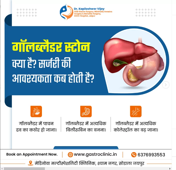 गॉलब्लैडर स्टोन क्या है? सर्जरी की आवश्यकता कब होती है?