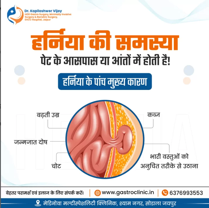 हर्निया के पांच मुख्य कारण