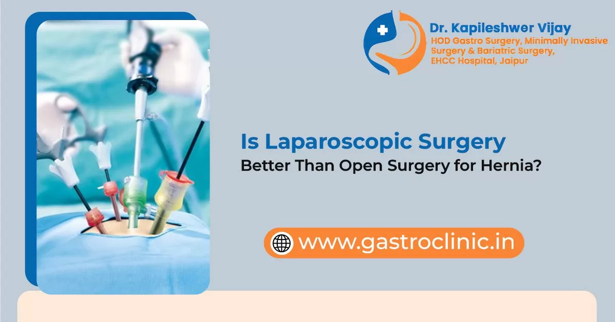 Is Laparoscopic Surgery Better Than Open Surgery for Hernia?