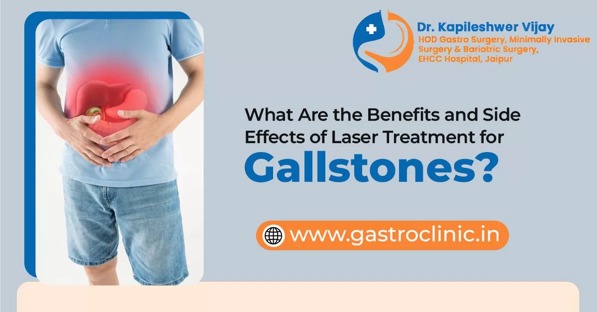 What Are the Benefits and Side Effects of Laser Treatment for Gallstones?