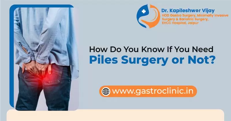 How Do You Know If You Need Piles Surgery or Not?