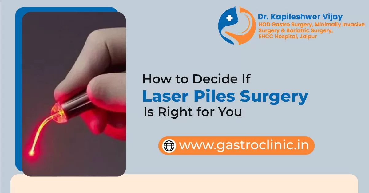 How to Decide If Laser Piles Surgery Is Right for You