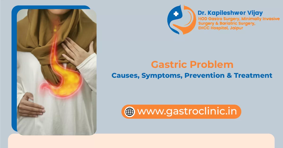 Gastric Problem: Causes, Symptoms, Prevention & Treatment